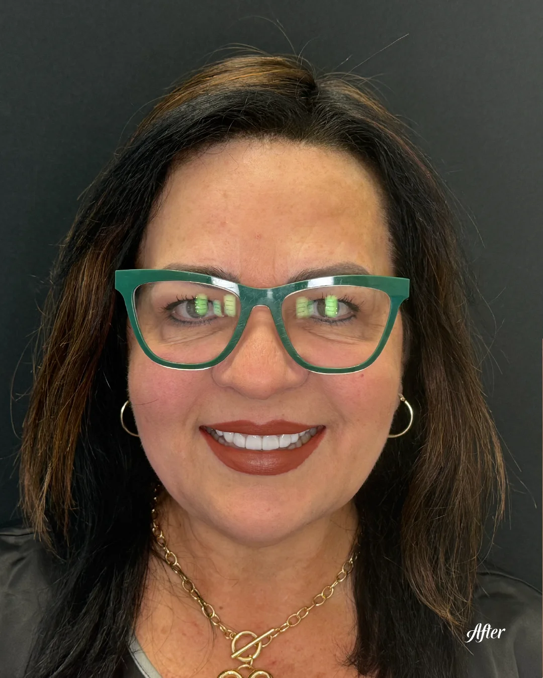 Healthy, polished smile of a patient after restorative dental care