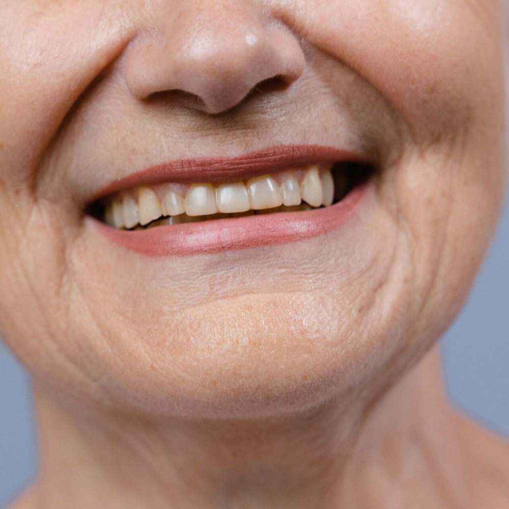 Woman with a bright, natural smile after dental implant treatment at Sunshine Smiles Dental Clinic